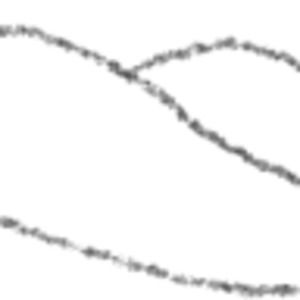 Meet your Posher, Woods mountain